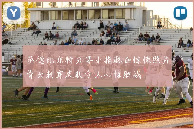 范德比尔特分享小指脱臼惊悚照片骨头刺穿皮肤令人心惊胆战